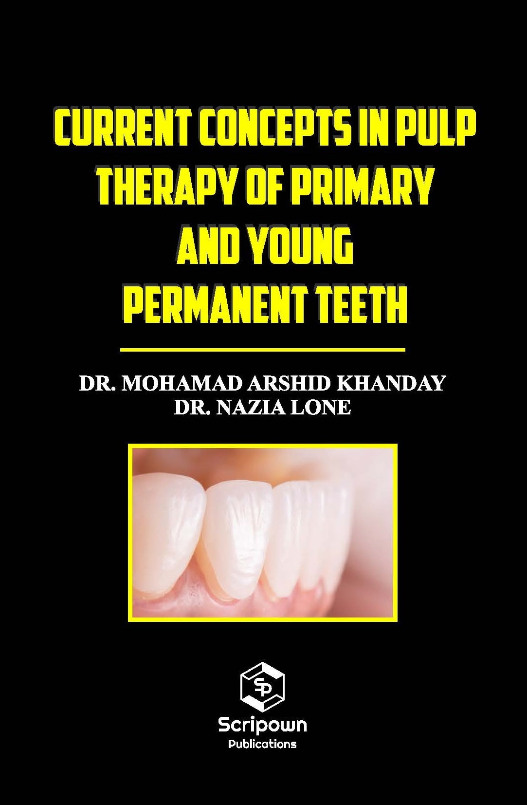 Current Concepts in Pulp Therapy of Primary and Young Permanent Teeth